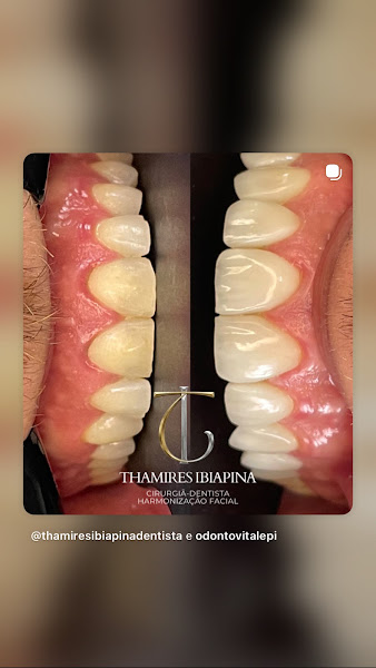Foto 2 de Dra Thamires Ibiapina Dentista