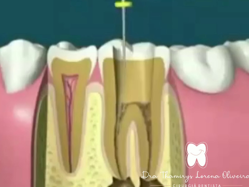 Foto 5 de Dra Thamirys Lorena Oliveira - Cirurgiã Dentista e Odontopediatra Méier