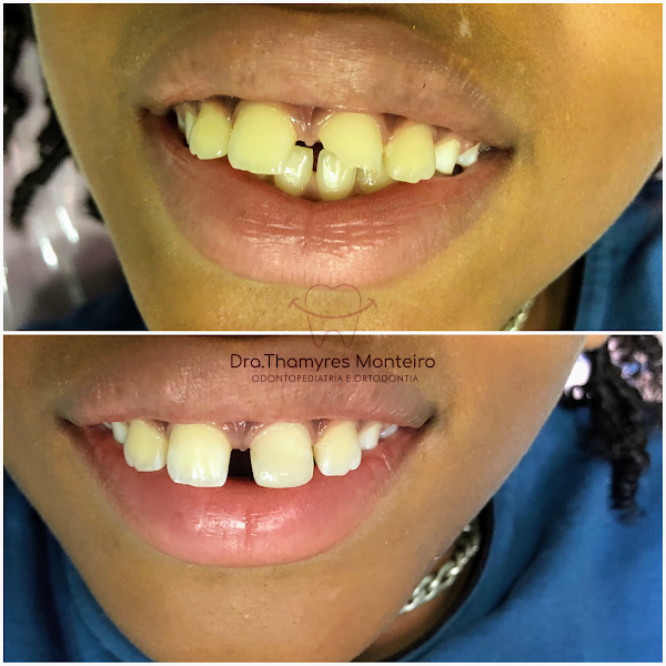 Foto 3 de Dra. Thamyres Monteiro-Dentista