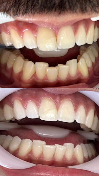 Foto 2 de Dra. Thamyrys Gonçalves Implantodontista