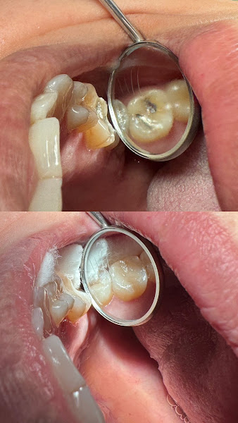 Foto 3 de Dra. Thamyrys Gonçalves Implantodontista