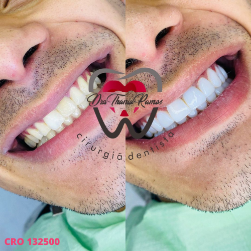 Foto 2 de Dra. Thania Ramos Consultório Odontológico Itaquera -SP