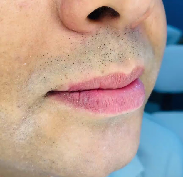 Foto 4 de Dra. Thania Ramos Consultório Odontológico Itaquera -SP