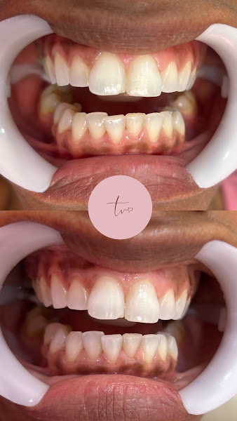 Foto 2 de Dra. Thátylla Velasco | Cirurgiã-Dentista - CRO-RJ 51616