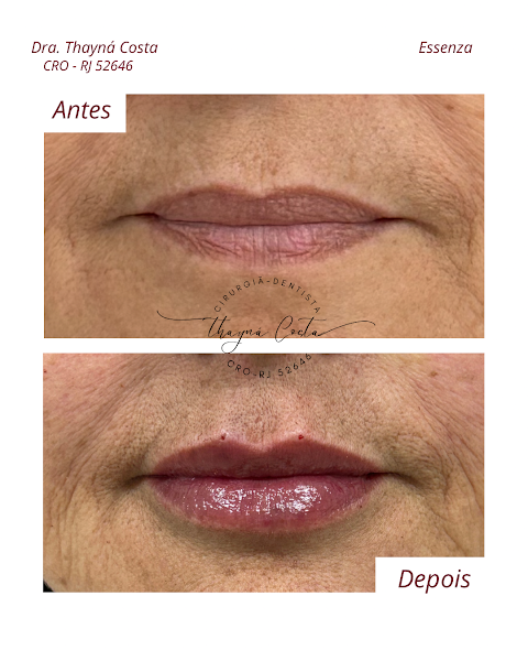 Foto 3 de Dra. Thayná Costa Odontologia