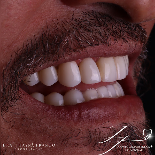 Foto 3 de Dra. Thayná Franco