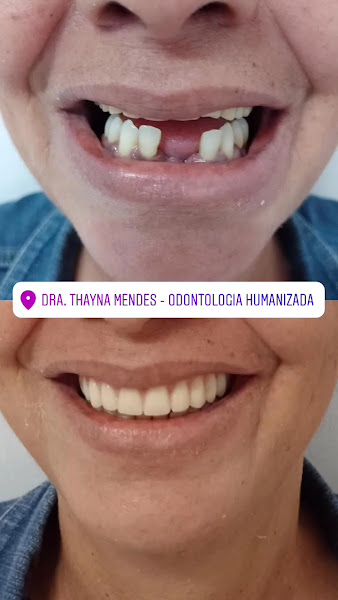 Foto 2 de Dra. Thayna Mendes | Odontologia Humanizada