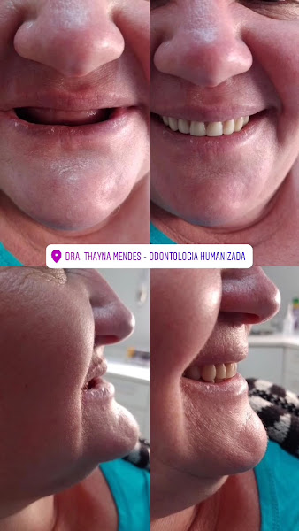 Foto 3 de Dra. Thayna Mendes | Odontologia Humanizada