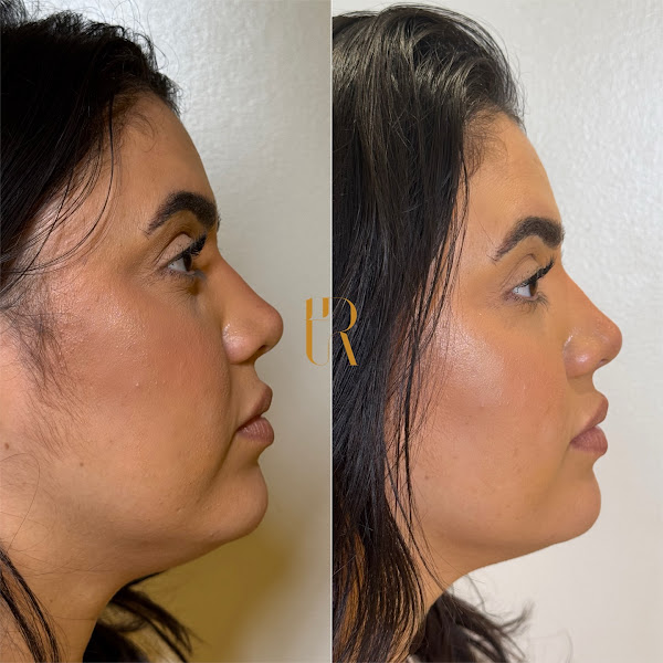 Foto 3 de Dra. Thayná Rodrigues | Harmonização Facial em Maracanaú