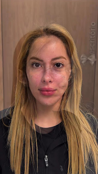 Foto 3 de Dra. Thayná Rosa | Harmonização Facial