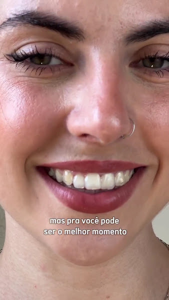 Foto 2 de Dra.Thaynara Vargas| Dentista | Aparelho ortodôntico invisível SouSmile