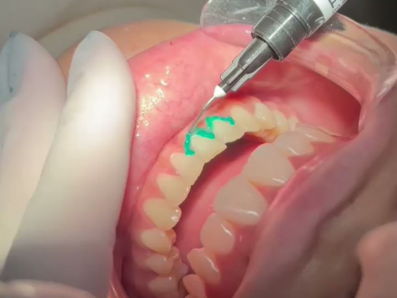 Foto 4 de Dra Thayne Pereira - Dentista Maceió