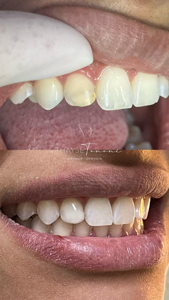 Foto 3 de Dra Thayse Tononi - Dentista Maceió