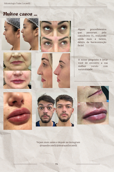 Foto 3 de Dra. Tuâni Locatelli | Dentista | Odontologia e Harmonização Facial | Cascavel - PR