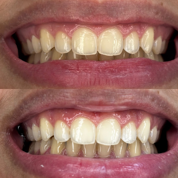 Foto 3 de Dra. Valéria Cabral Prata / Dentista Cpa Dra Valeria Cabral Prata