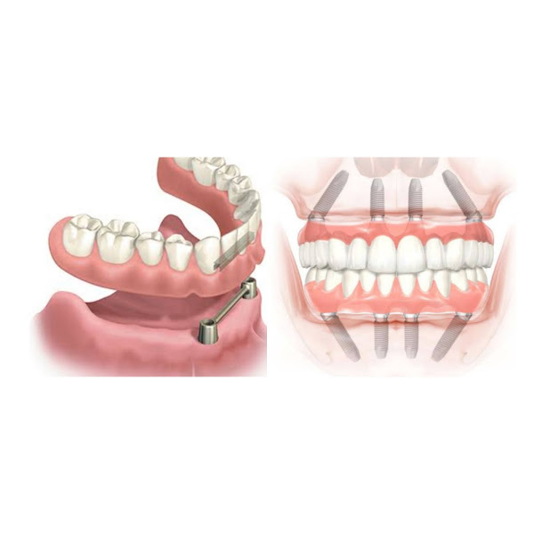 Foto 3 de DRA VALÉRIA TEIXEIRA | IMPLANTODONTIA