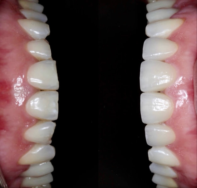 Foto 2 de Dra. Vanessa Chazan e Dr. Ari Chazan / Prótese dentária e implantes em Porto Alegre