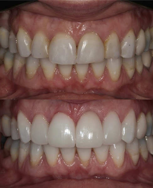 Foto 4 de Dra. Vanessa Chazan e Dr. Ari Chazan / Prótese dentária e implantes em Porto Alegre