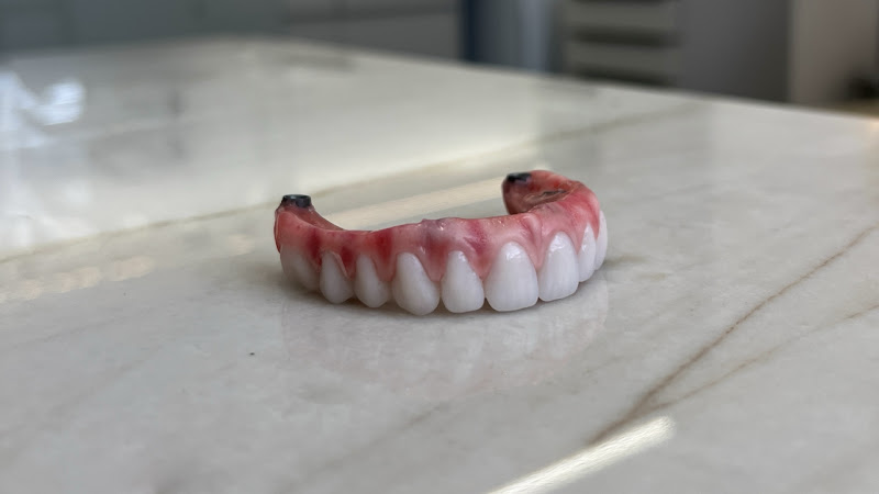 Foto 2 de Dra. Vanessa Malheiros | Implantes Dentários