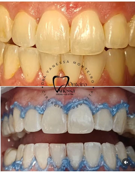 Foto 2 de Dra.Vanessa Monteiro Cirurgiã -Dentista & Harmonização Orofacial