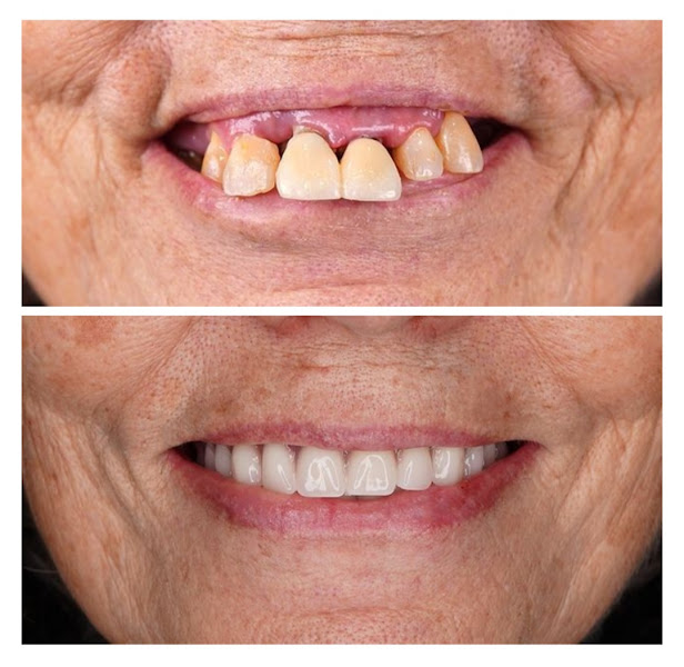 Foto 3 de DRA. VANESSA NEVES - ODONTOLOGIA ESPECIALIZADA