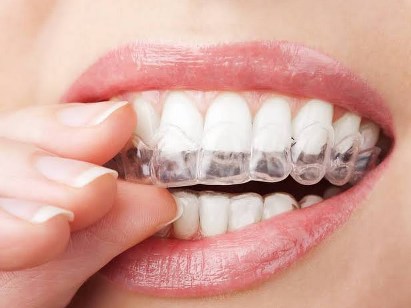 Foto 2 de Dra. Vanessa Tramontino - Clínica de implante dentário em Piracicaba