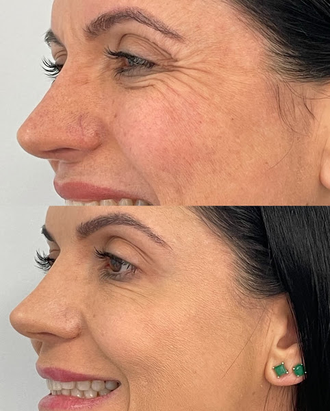Foto 2 de Dra. Vania Costa | Especialista em Harmonização Facial | Botox | Fios de PDO em Niterói RJ
