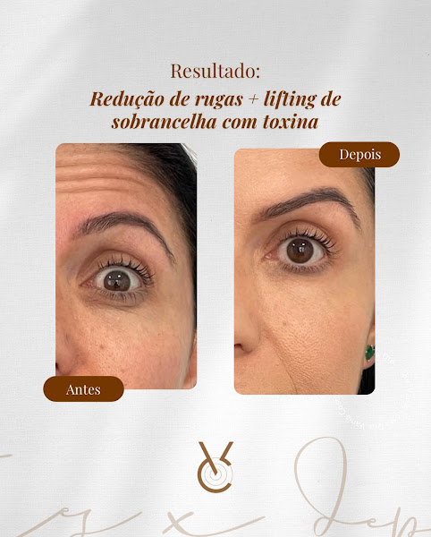 Foto 3 de Dra. Vania Costa | Especialista em Harmonização Facial | Botox | Fios de PDO em Niterói RJ