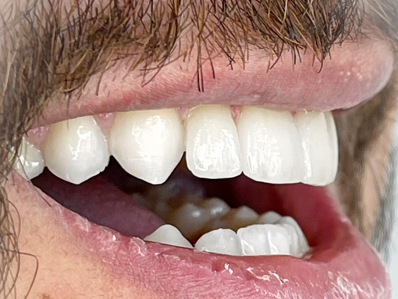 Foto de Dra. Vanuza Cunha, Dentista Especialista, Invisalign Doctor, Implante, Lentes de Contato Dental