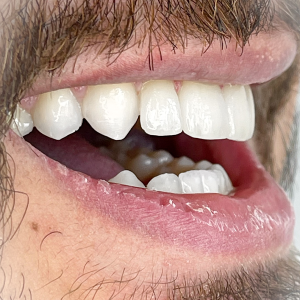 Foto 2 de Dra. Vanuza Cunha, Dentista Especialista, Invisalign Doctor, Implante, Lentes de Contato Dental