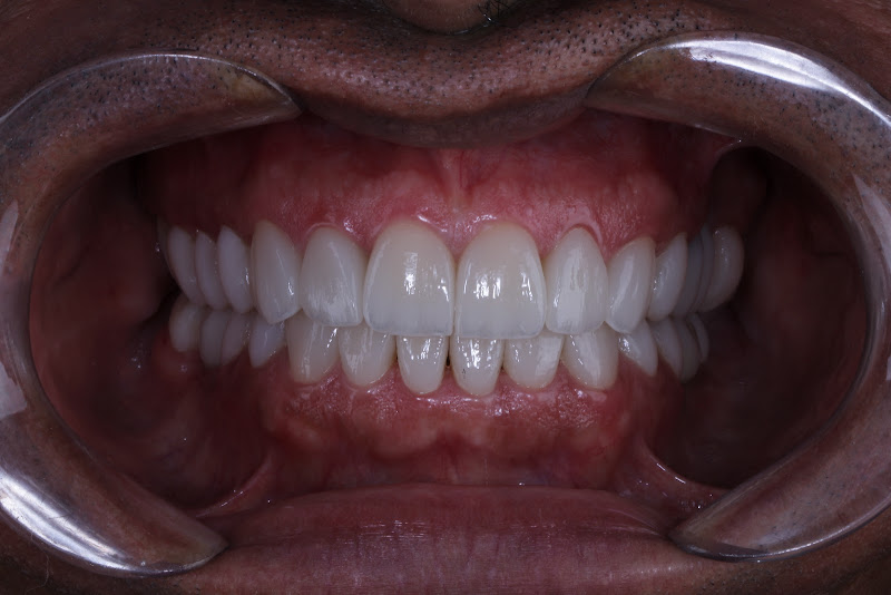 Foto 2 de Dra. Victória Amâncio - Dentista/Facetas (Ópera Clínica)