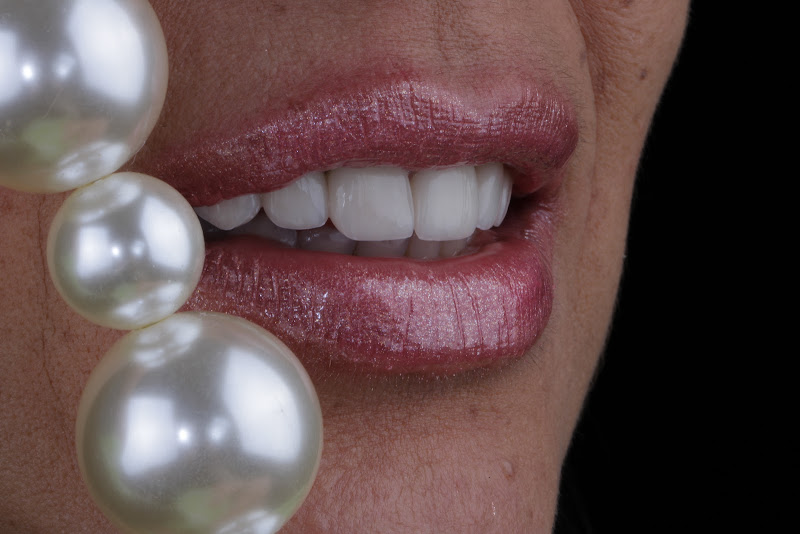 Foto 3 de Dra. Victória Amâncio - Dentista/Facetas (Ópera Clínica)