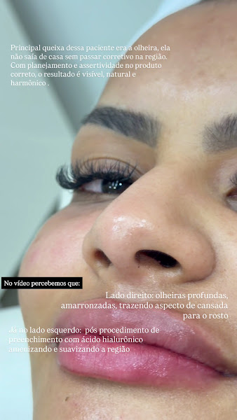 Foto 2 de Dra. Victória Dal Cortivo - Odontologia e Estética