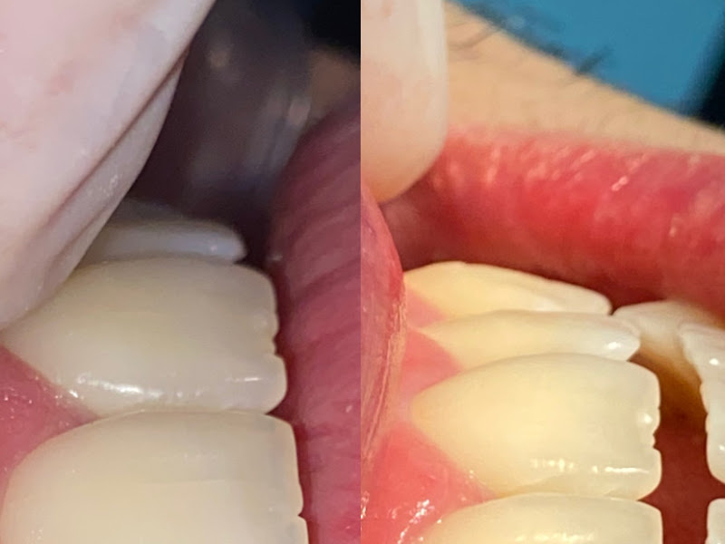 Foto de Dra Victória Geraldino | Reabilitação oral e estética | Prótese em Piracicaba