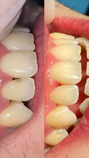 Foto 2 de Dra Victória Geraldino | Reabilitação oral e estética | Prótese em Piracicaba