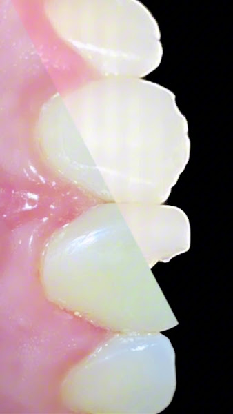 Foto 3 de Dra Victória Geraldino | Reabilitação oral e estética | Prótese em Piracicaba