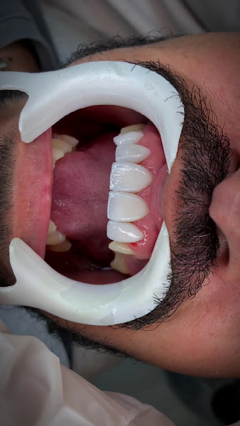 Foto 3 de Dra. Victoria Quintanilha l Dentista São Gonçalo