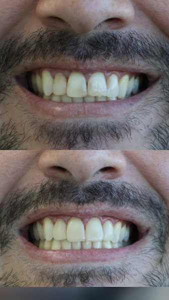 Foto 3 de Dra Victória Sousa | DENTISTA