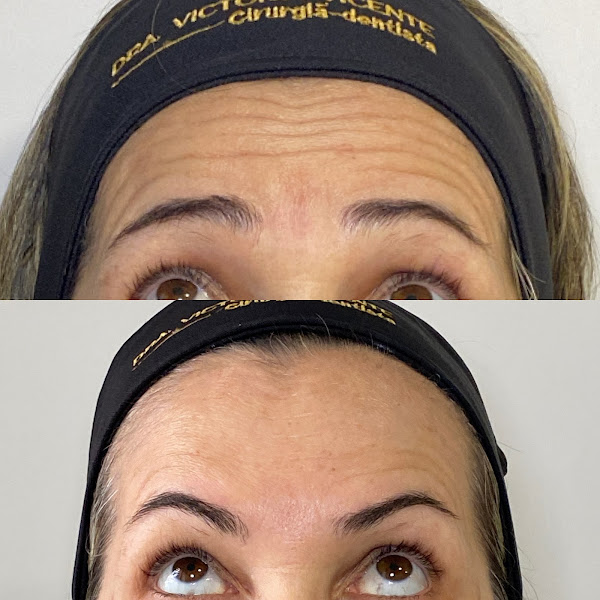 Foto 3 de Dra. Victoria Vicente - Dentista e Harmonização Orofacial