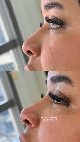 Foto 2 de Dra. Virgínia Negri - Harmonização Orofacial e Odontologia