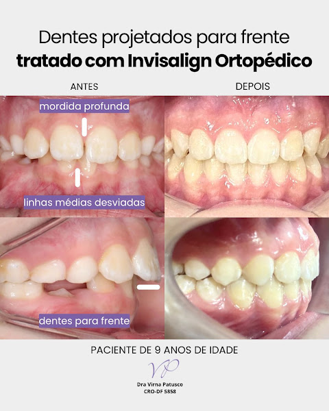 Foto 2 de Dra Virna Patusco DTM e Dor Orofacial, Odontologia do Sono e Ortodontia