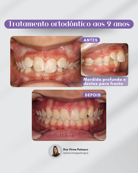 Foto 4 de Dra Virna Patusco DTM e Dor Orofacial, Odontologia do Sono e Ortodontia