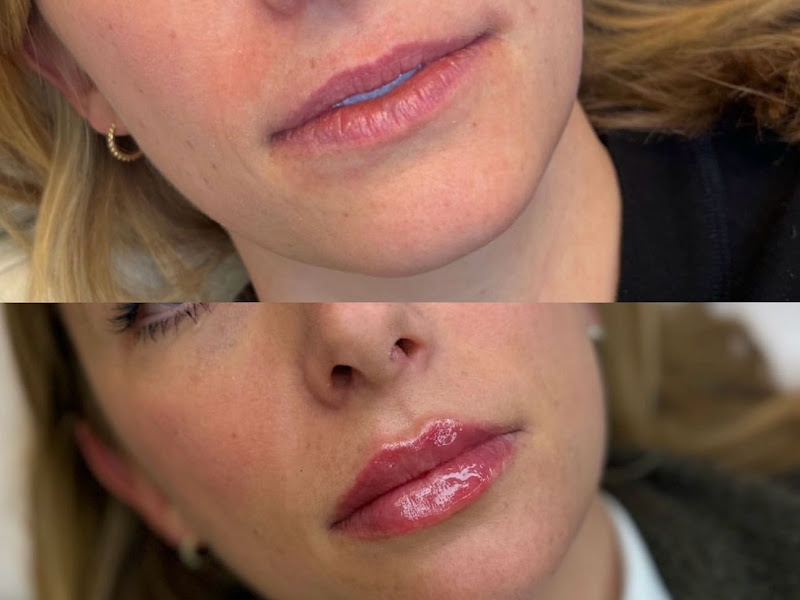 Foto de Dra. Vitória Hagge | Cirurgiã Dentista | Referência em Preenchimento Labial | Especialista em Harmonização Orofacial