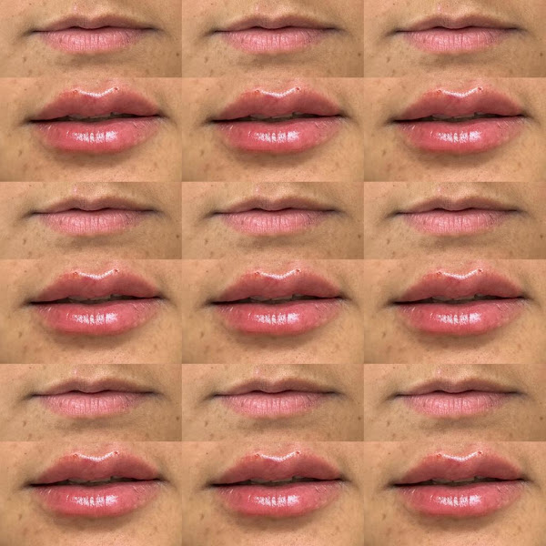 Foto 5 de Dra Vitória Rigato - Dentista em Guarulhos