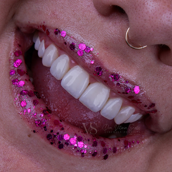 Foto 3 de Dra. Vitória Santos - Cirurgiã Dentista