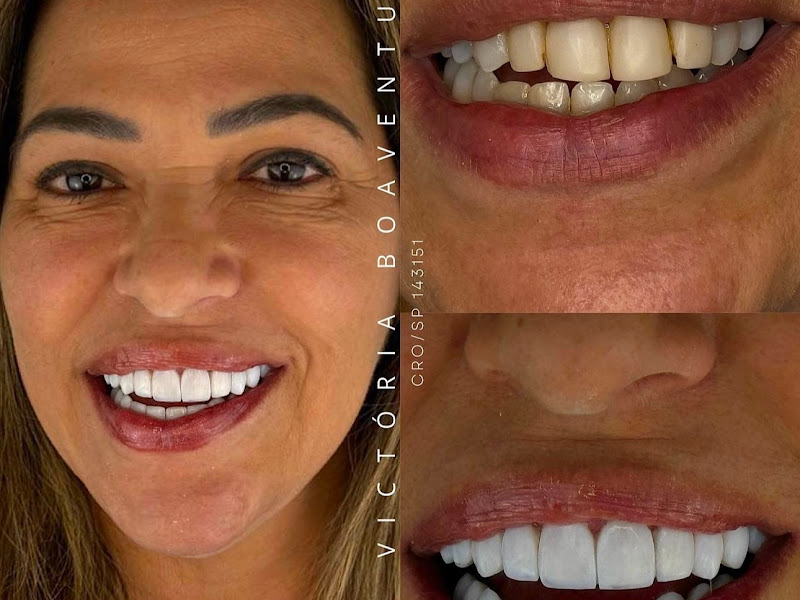 Foto 8 de Dra Vitória Umeda | Invisalign e Aparelhos | Dentista em Marília-SP