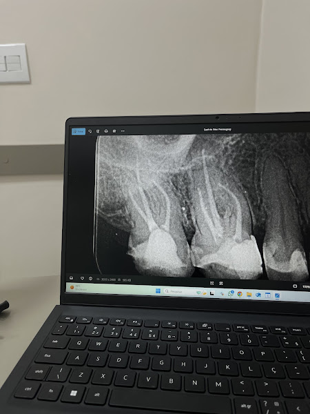 Foto 2 de Dra. Vitoria Vieira | ENDODONTISTA