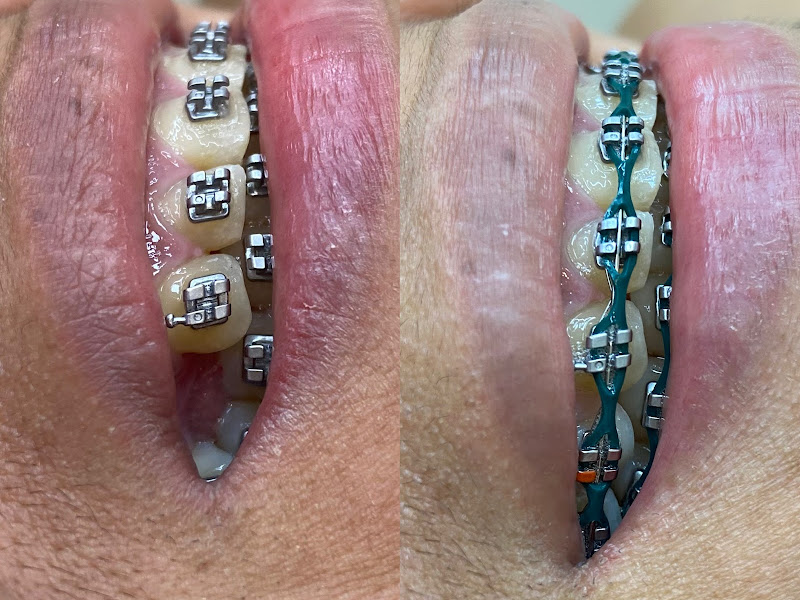 Foto 3 de Dra. Vivian Sousa, Dentista