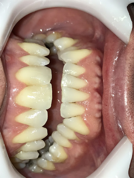 Foto 3 de Dra Viviane Barbosa/ Dentista Juiz de Fora/ Ortodontia