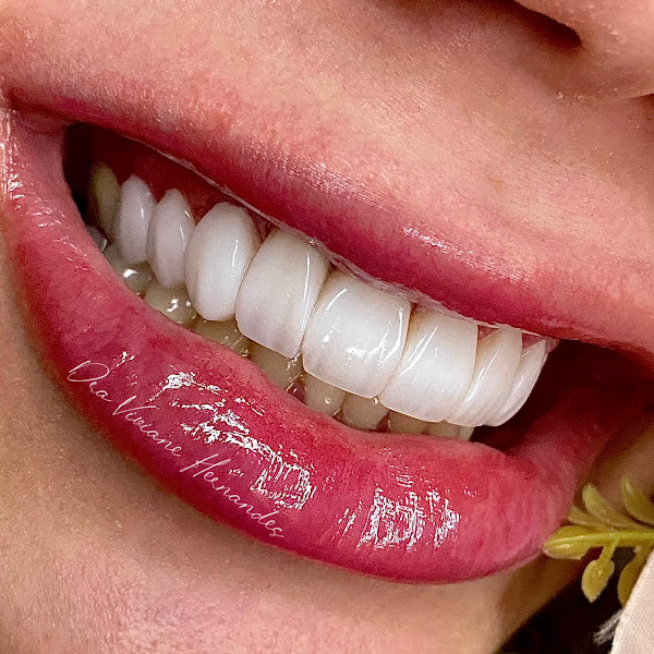 Foto 2 de Dra Viviane Hernandes - Dentista - Odontologia Especializada